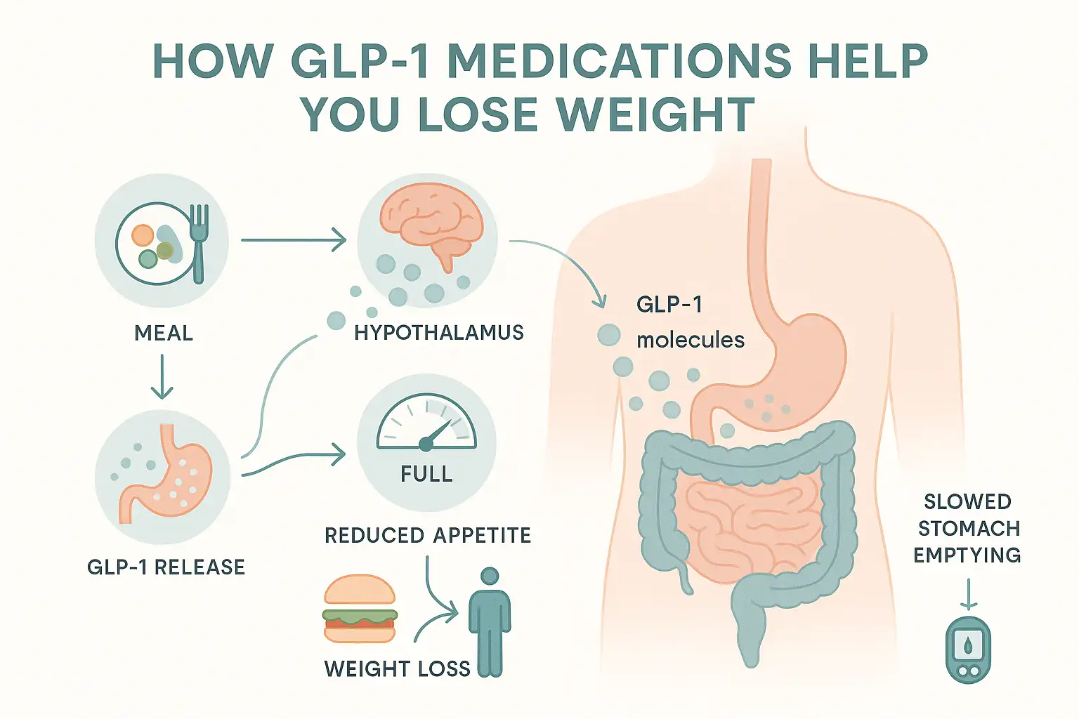 Diagram illustrating how GLP-1 medications aid weight loss, featuring meal triggering GLP-1 release, hypothalamus signaling fullness, reduced appetite, and slowed stomach emptying leading to weight loss.