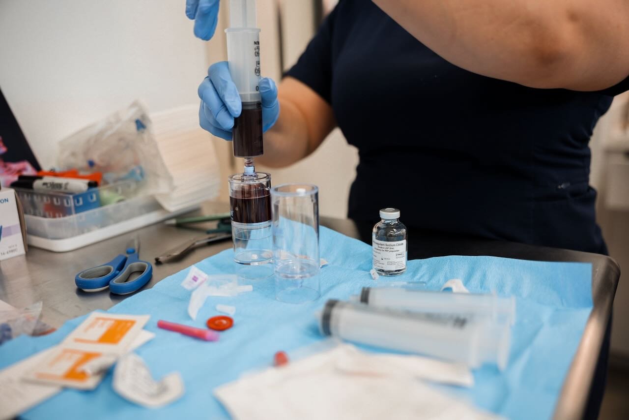 Healthcare professional preparing plasma for young plasma therapy, with syringes, vials, and medical supplies on a sterile surface, emphasizing the process of plasma treatment.